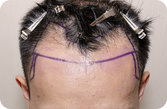 non-surgical-solutions-1