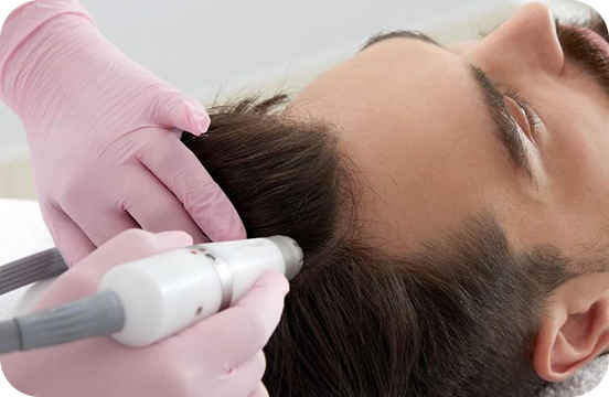 womens-hair-restoration