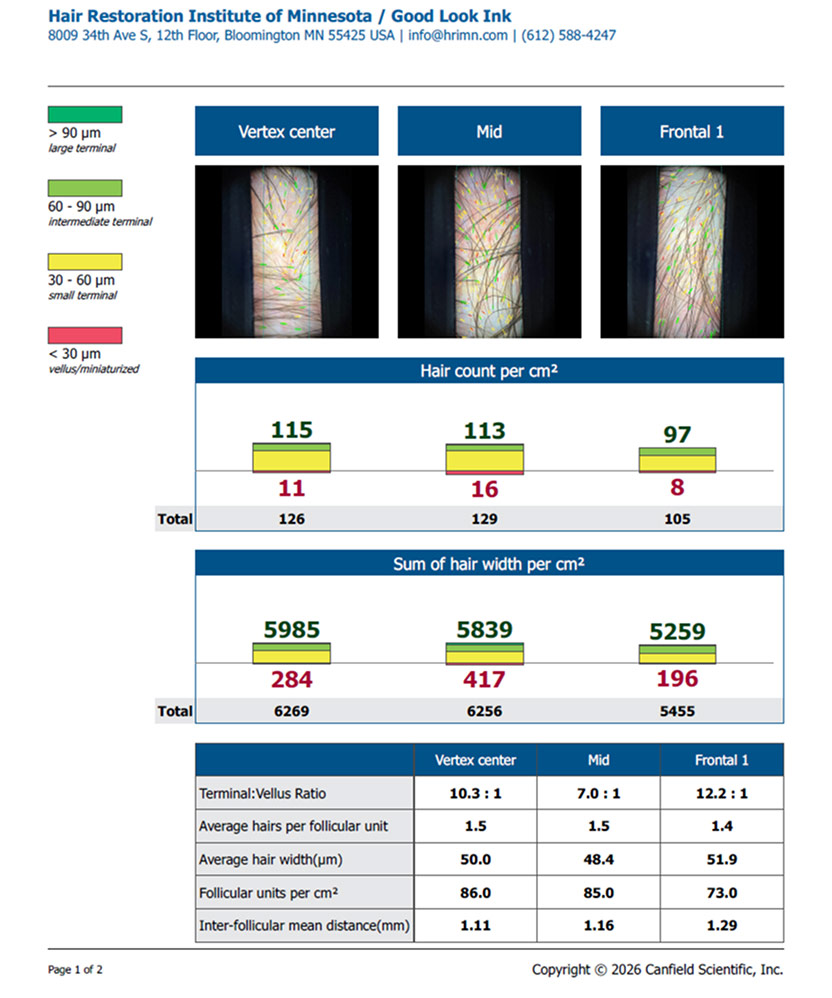 RealEvaluationCalculator