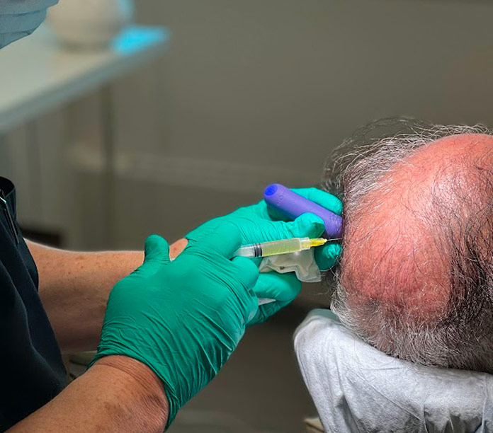 Non-SurgicalTreatments