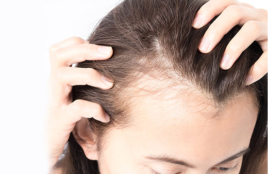 womens-hair-restoration